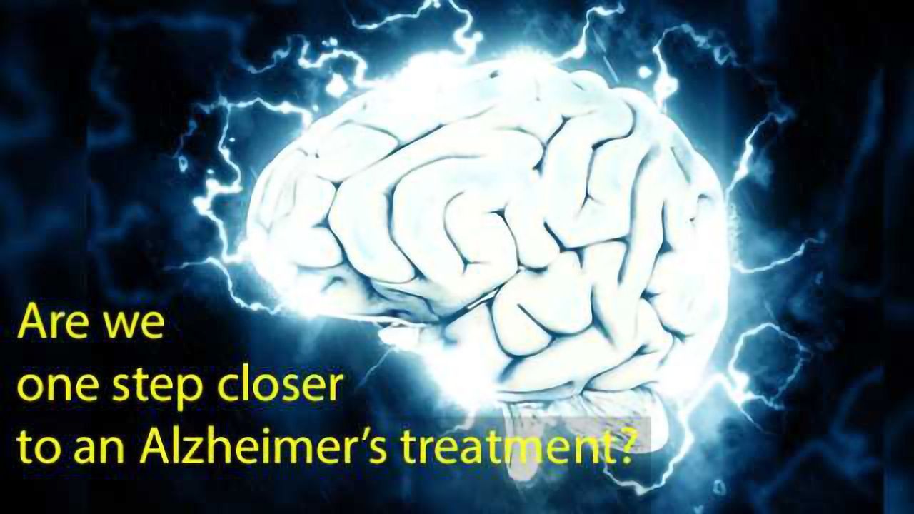 New Drug Class: Potential Therapeutics for Alzheimer’s Disease?