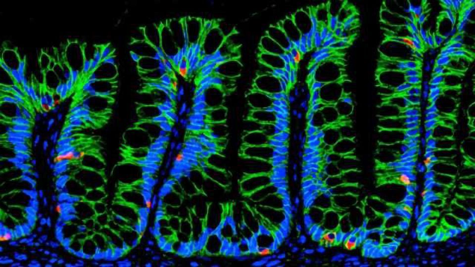 Synthetic Hydrogels Deliver Cells to Repair Intestinal Injuries