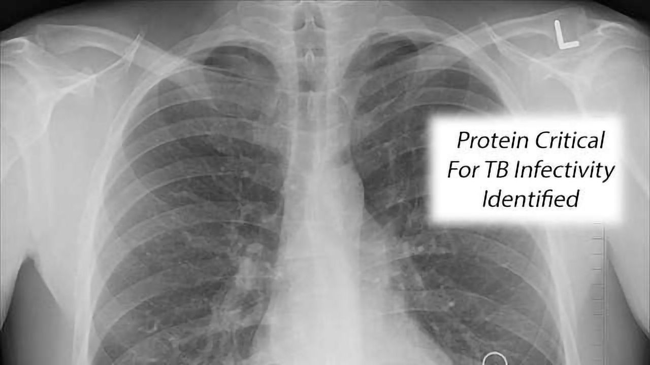 Step Toward Possible New Anti-TB Treatment Path