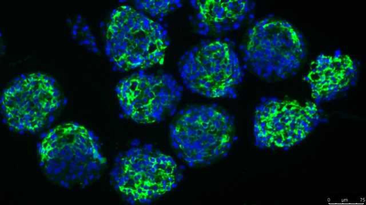 InSphero Novel 3D Human Liver Fibrosis Model Presented at Annual Liver Meeting®.
