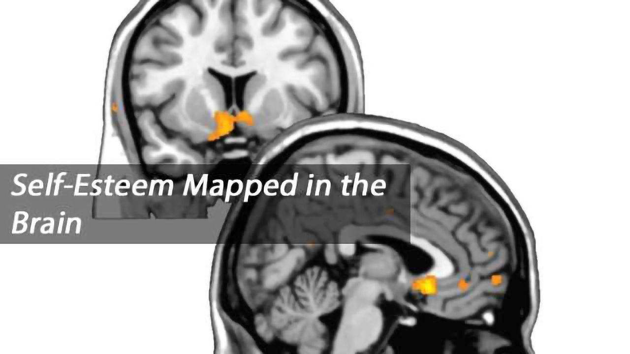 Brain Scan Measures Dynamic Changes in Self-Esteem in Real Time