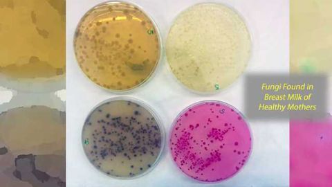 Detection of the Presence of Fungi in Human Breastmilk Samples from Healthy Mothers
