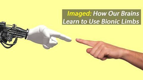 Observing How the Brain Learns to Control a Bionic Limb