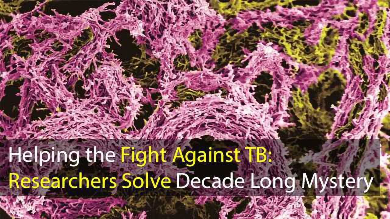 Helping the Fight Against TB: Researchers Solve Decade Long Mystery