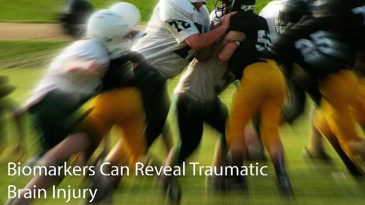 Biomarkers Can Reveal Tramautic Brain Injury