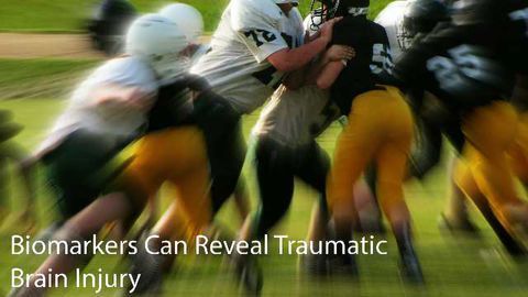 Biomarkers Can Reveal Tramautic Brain Injury