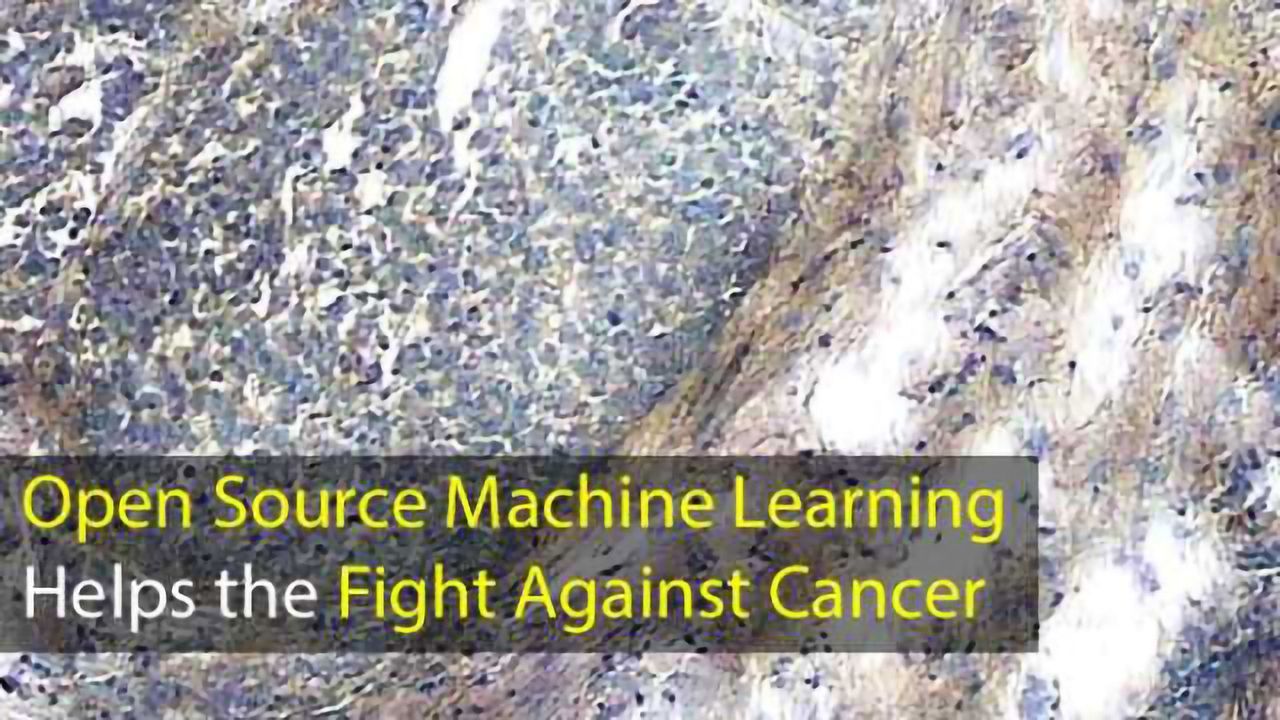 Open Source Machine Learning Helps the Fight Against Cancer
