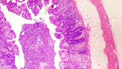 New Insights into the Release of Molecules Involved in Inflammatory Diseases