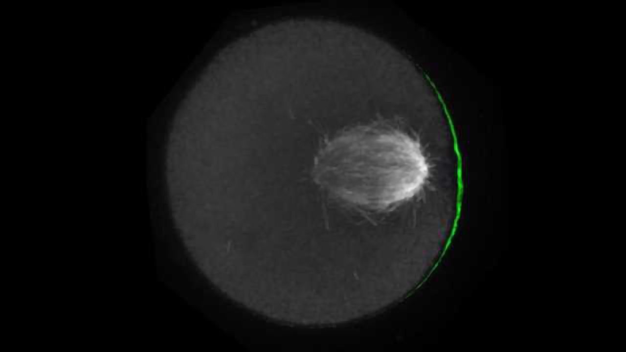 How Chromosomes ‘Cheat’ for the Chance to Get Into an Egg