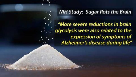 NIH Study: Brain Glucose Levels Linked to Alzheimer’s Severity