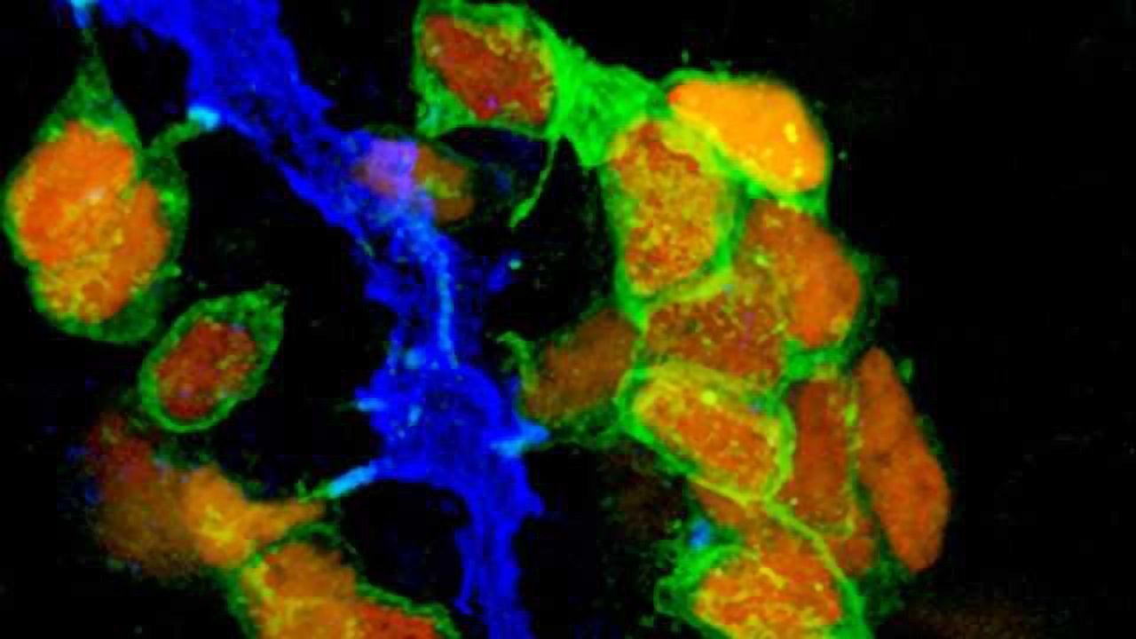 Stem Cells Pave the Way for New Treatment of Diabetes