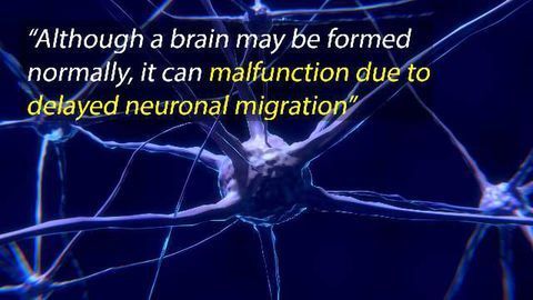Rescue-able Disruption of Neuronal Migration That Induces Autism-like Behavior in Rats