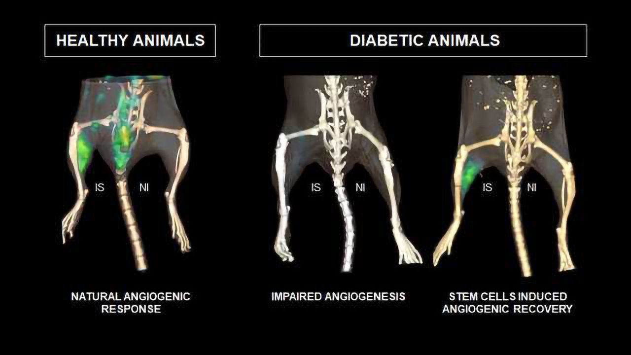 Stem Cells From Muscle Could Address Diabetes-related Circulation Problems