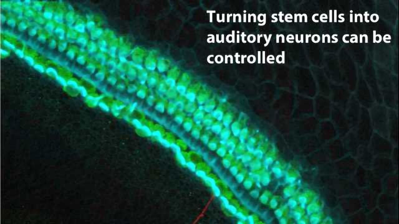 Inner Ear Stem Cells May Someday Restore Hearing