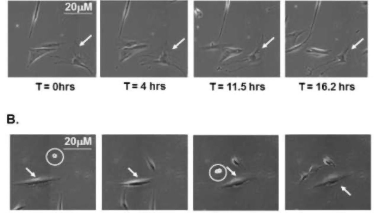 Old Human Cells Rejuvenated in Breakthrough Discovery on Ageing