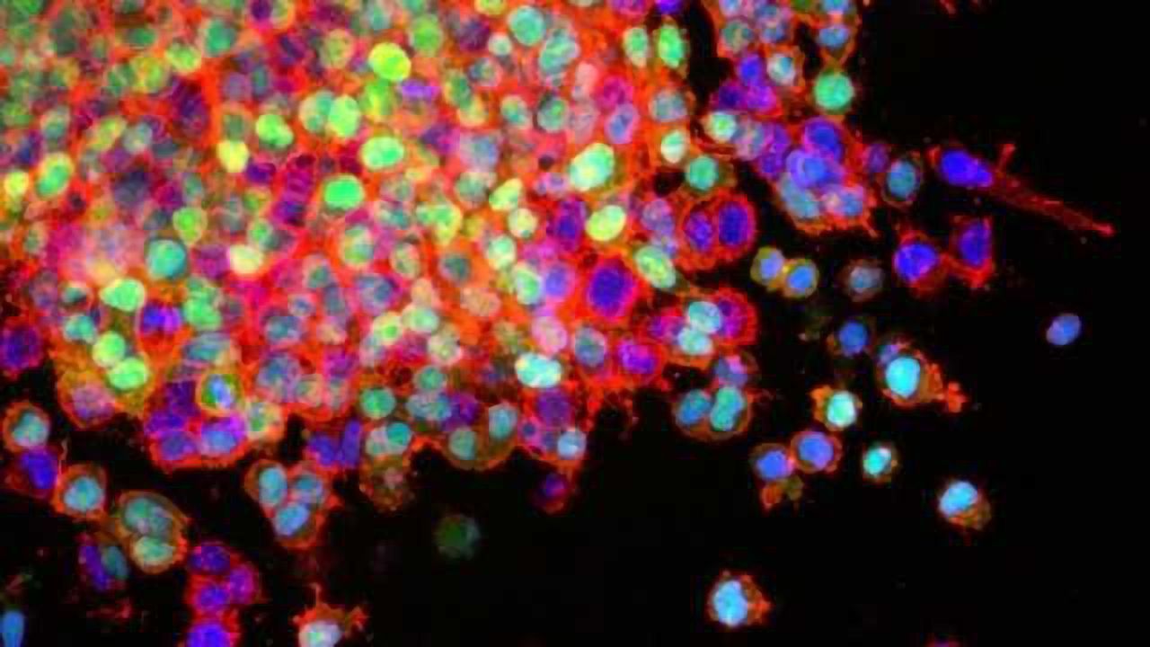 Multiple Mutations Drive Cancer Drug Resistance