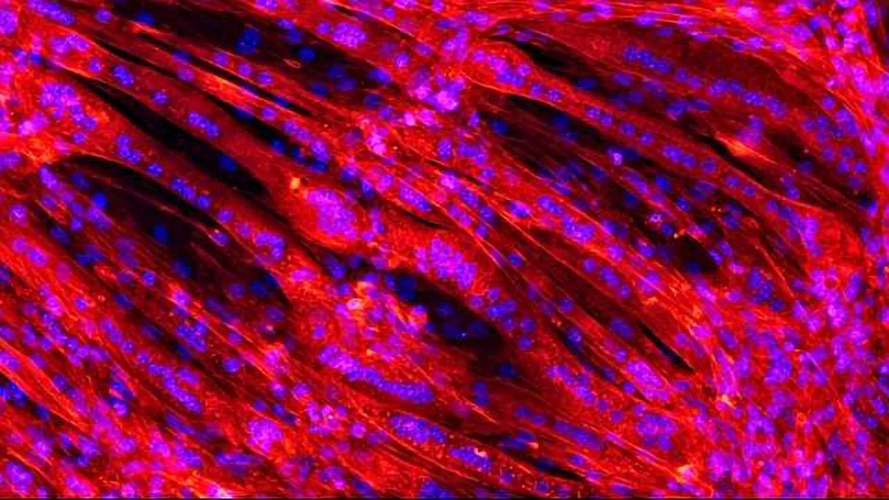 One Step Closer Towards An Artificial Heart