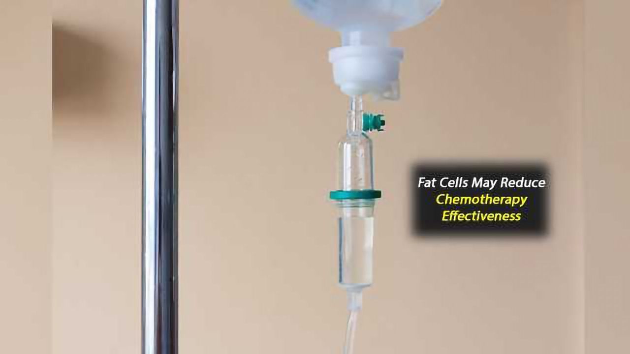 Fat Cells May Inactivate Chemotherapeutic Drug