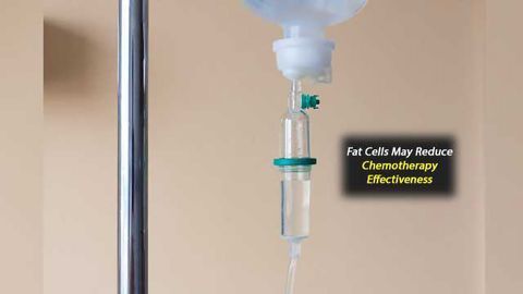 Fat Cells May Inactivate Chemotherapeutic Drug