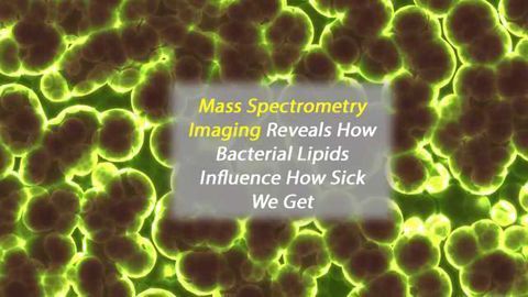 Lipids Influence How Sick You Get From a Bacterial Infection