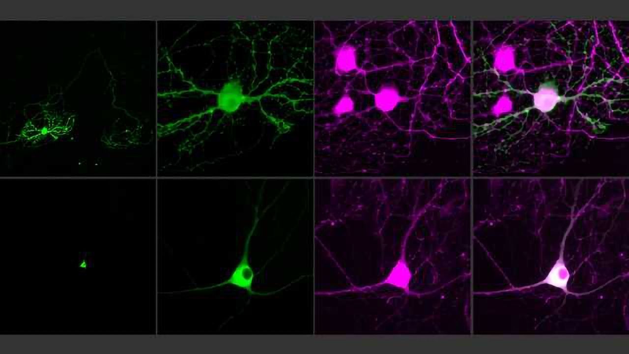Next-generation Optogenetic Molecules Used to Control Single Neurons