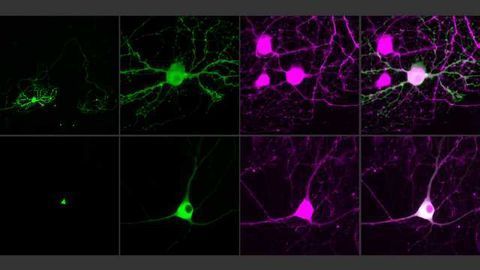 Next-generation Optogenetic Molecules Used to Control Single Neurons