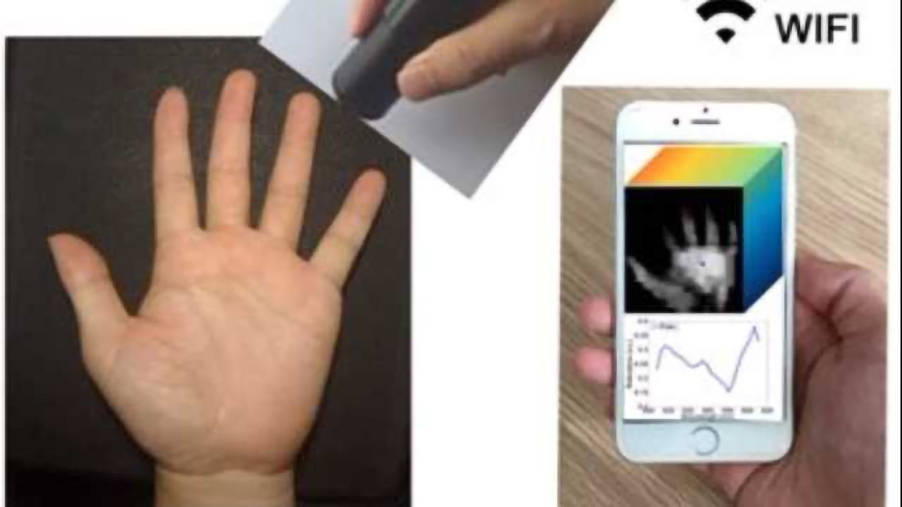 Wireless Handheld Spectrometer Holds Promise for Remote Medical Diagnostics