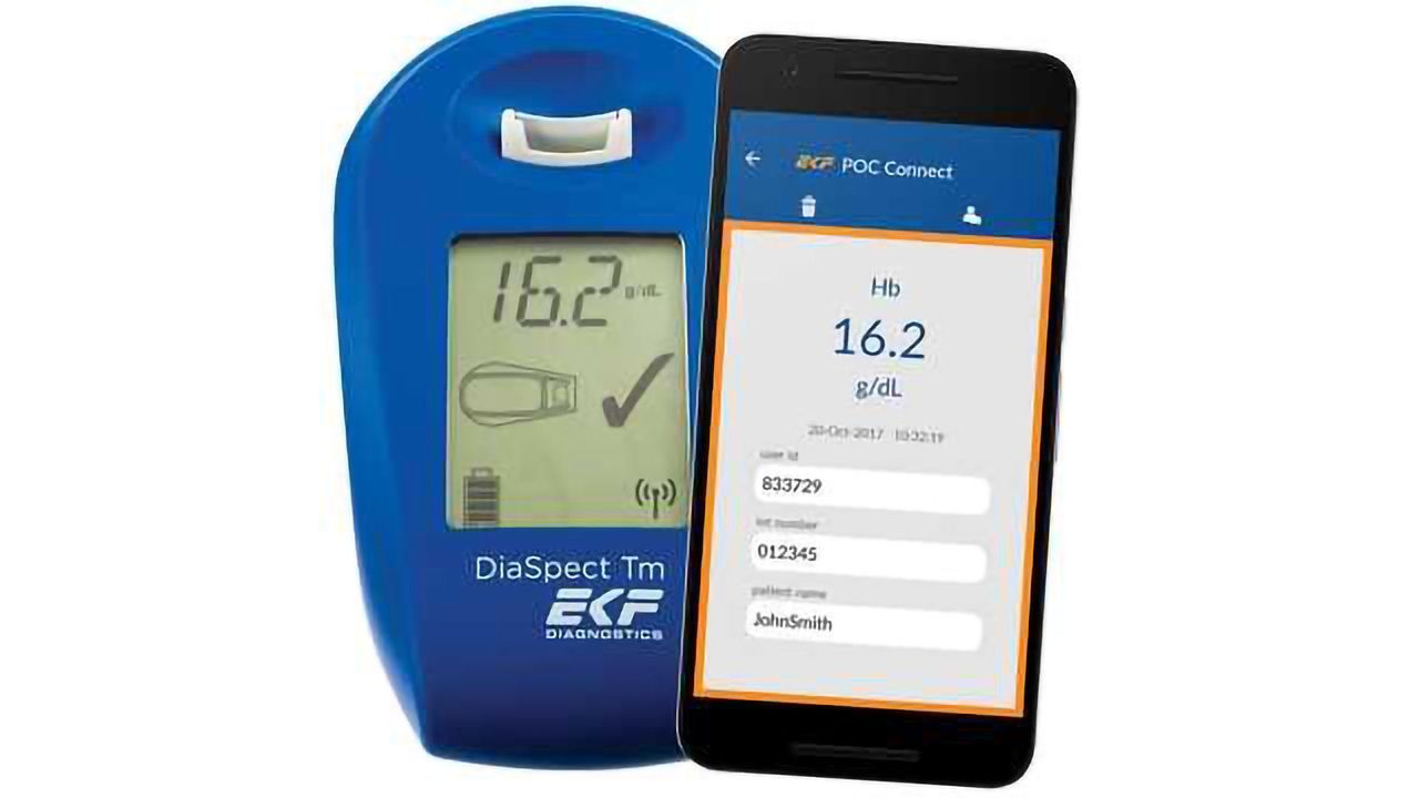 EKF Introduces Mobile Data Management Solution for the DiaSpect Tm POC Hemoglobin Analyzer
