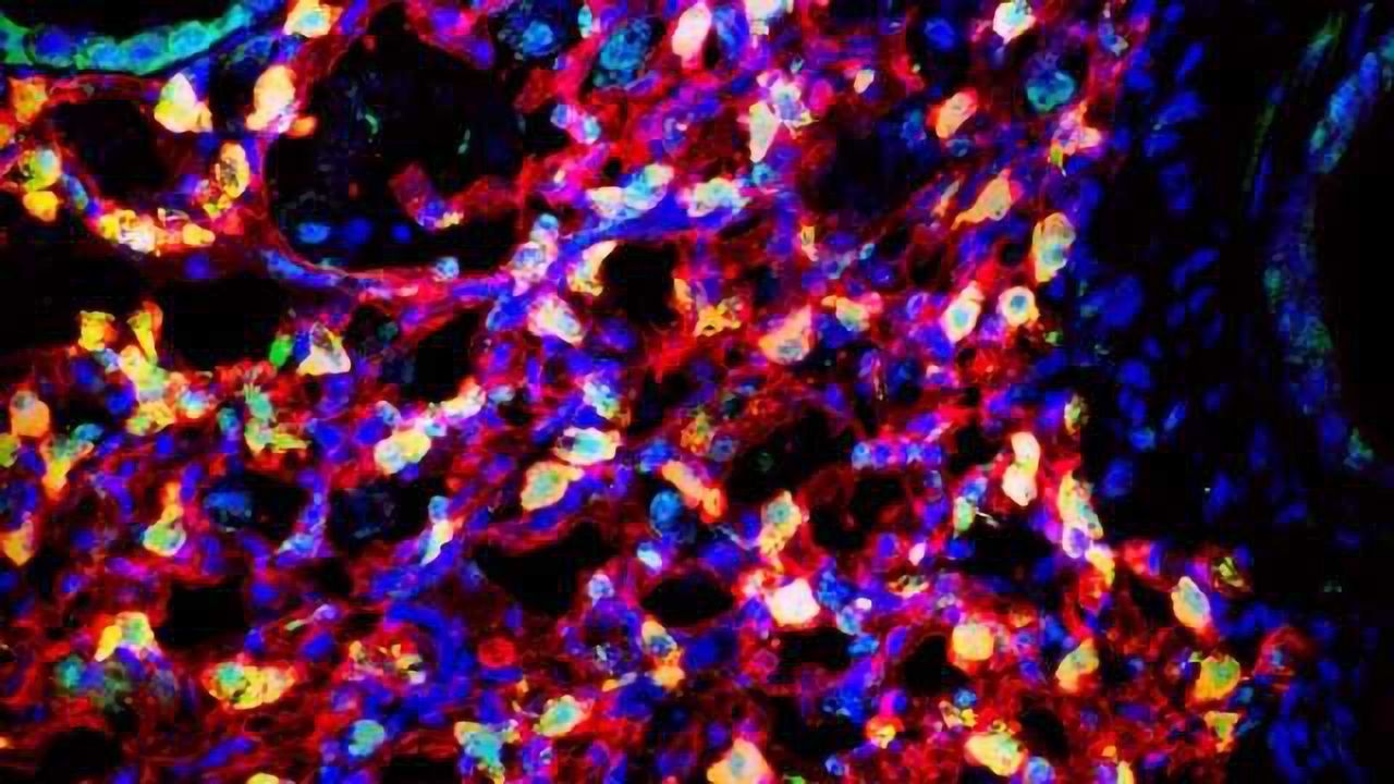 Multipotent Lung Stem Cells Identified