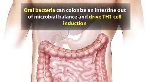 Oral Bacteria in the Gut Could Drive IBD