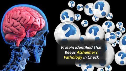 New Player in Alzheimer's Disease Pathogenesis Identified