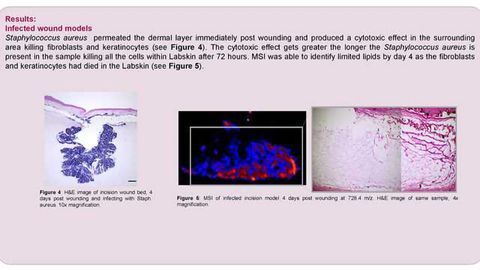 Development and Assessment of Non-Infected and Infected Skin Models Using MALDI-MSI