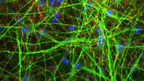 Elpis BioMed Closes Funding Round to Commercialise Novel Technology Platform for Generating Human Cell Types