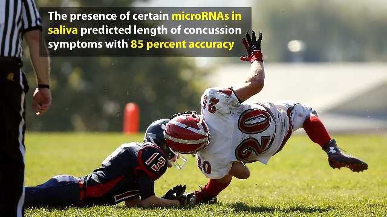 Molecules in Spit Could Help Diagnose Concussions