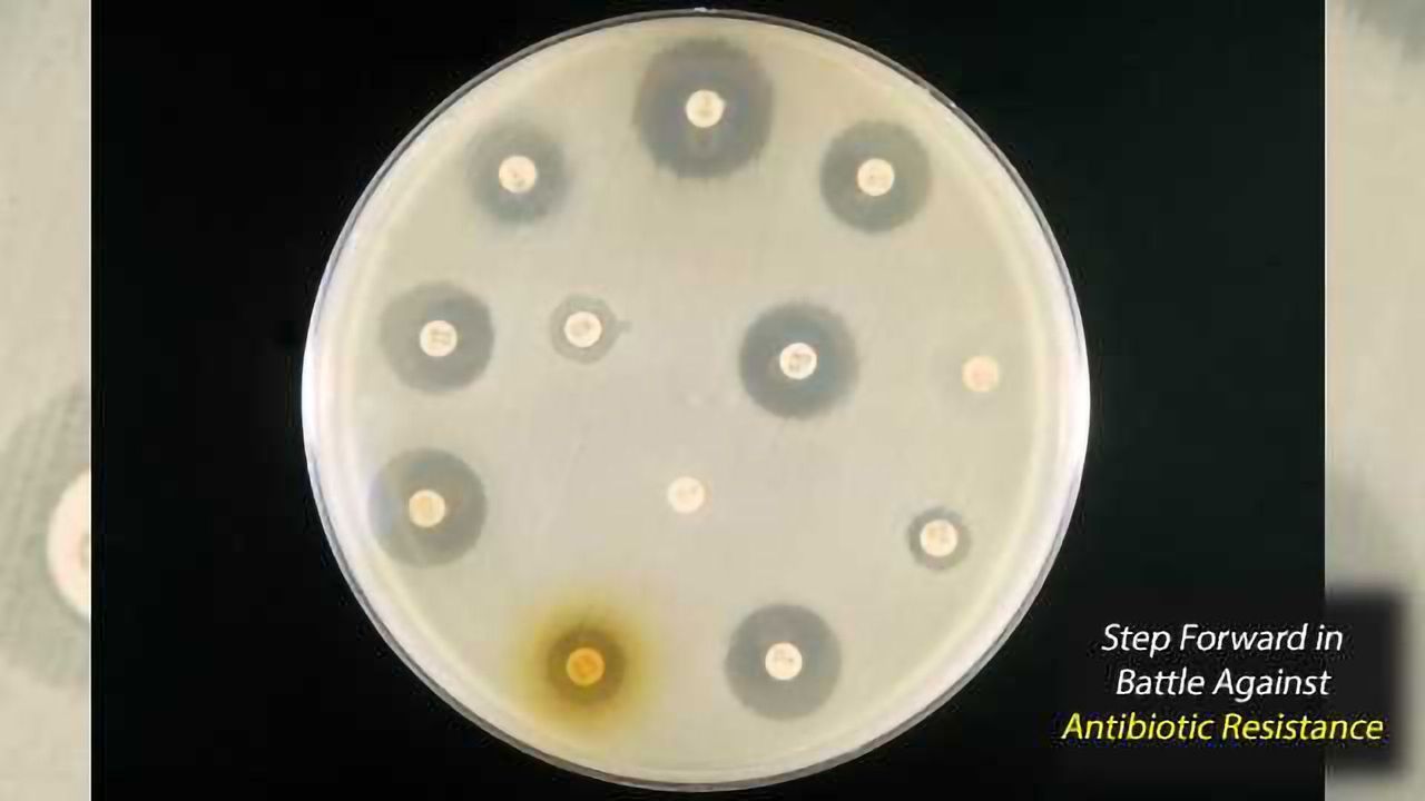 Antibiotic Resistance: Researchers Succeed in Blocking Genes of Resistance