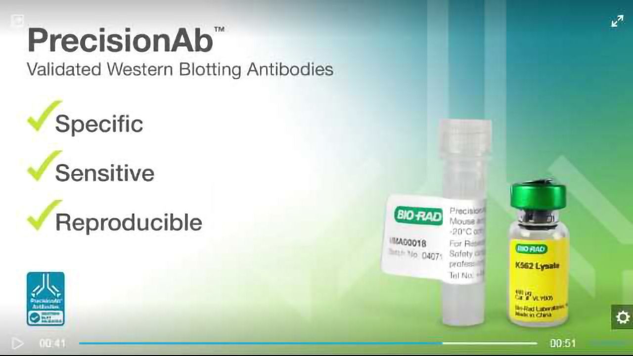 Resolve Your Western Blotting Woes with Better Antibodies