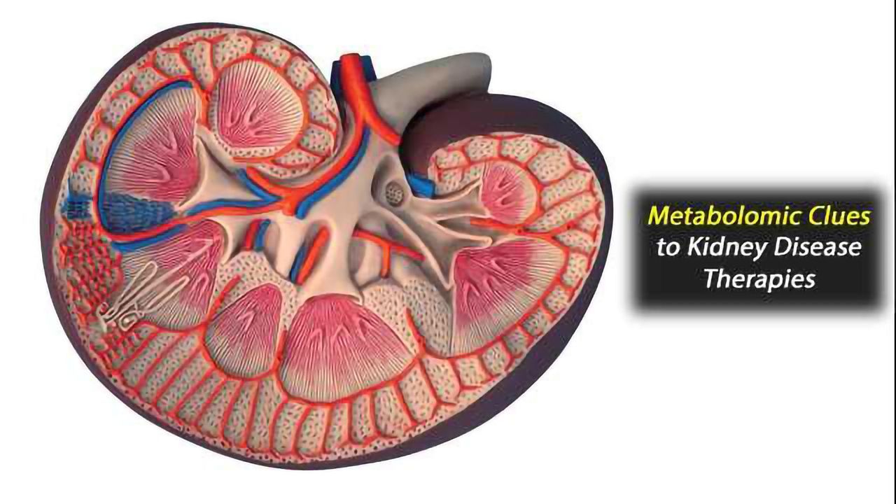 Metabolites Altered in Chronic Kidney Disease
