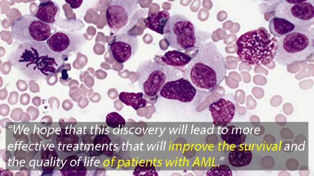 New Drug Target for Acute Myeloid Leukaemia