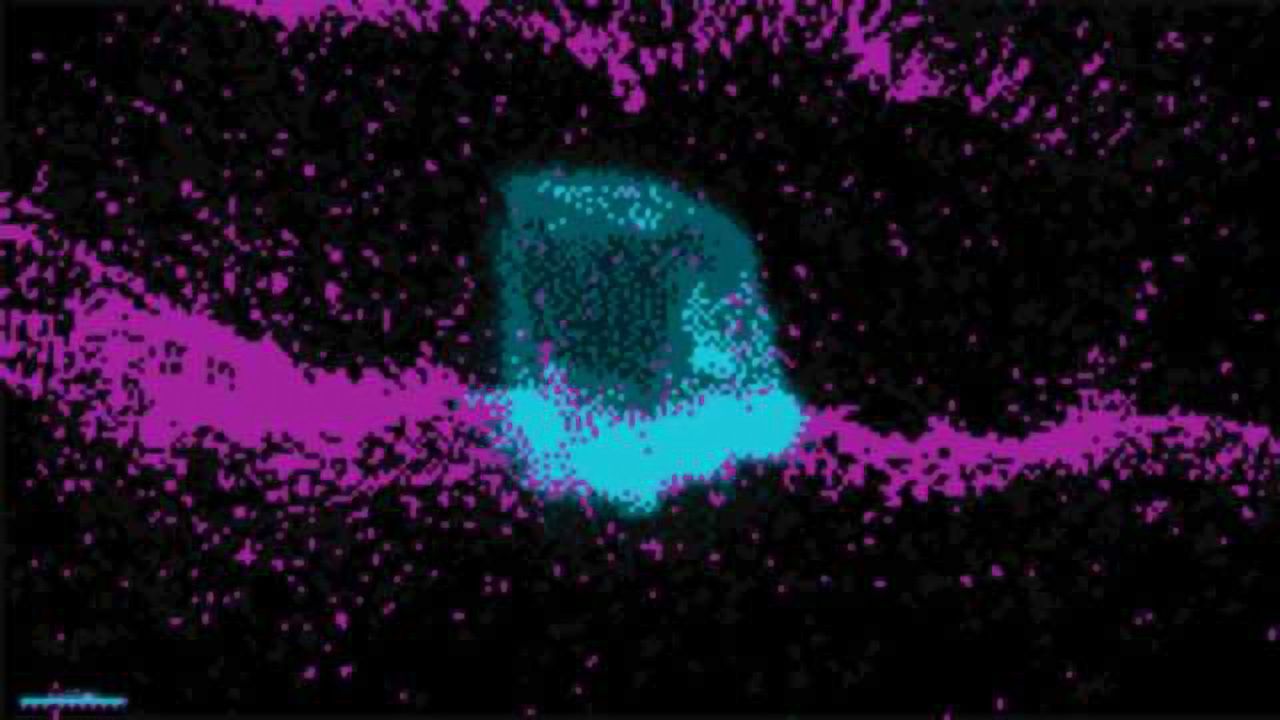Cells Bulge To Squeeze Through Barriers