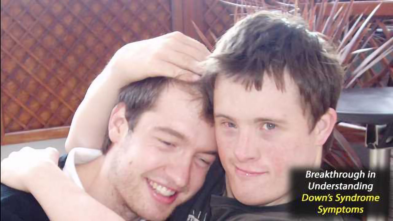 New Discoveries in Down's Syndrome Research