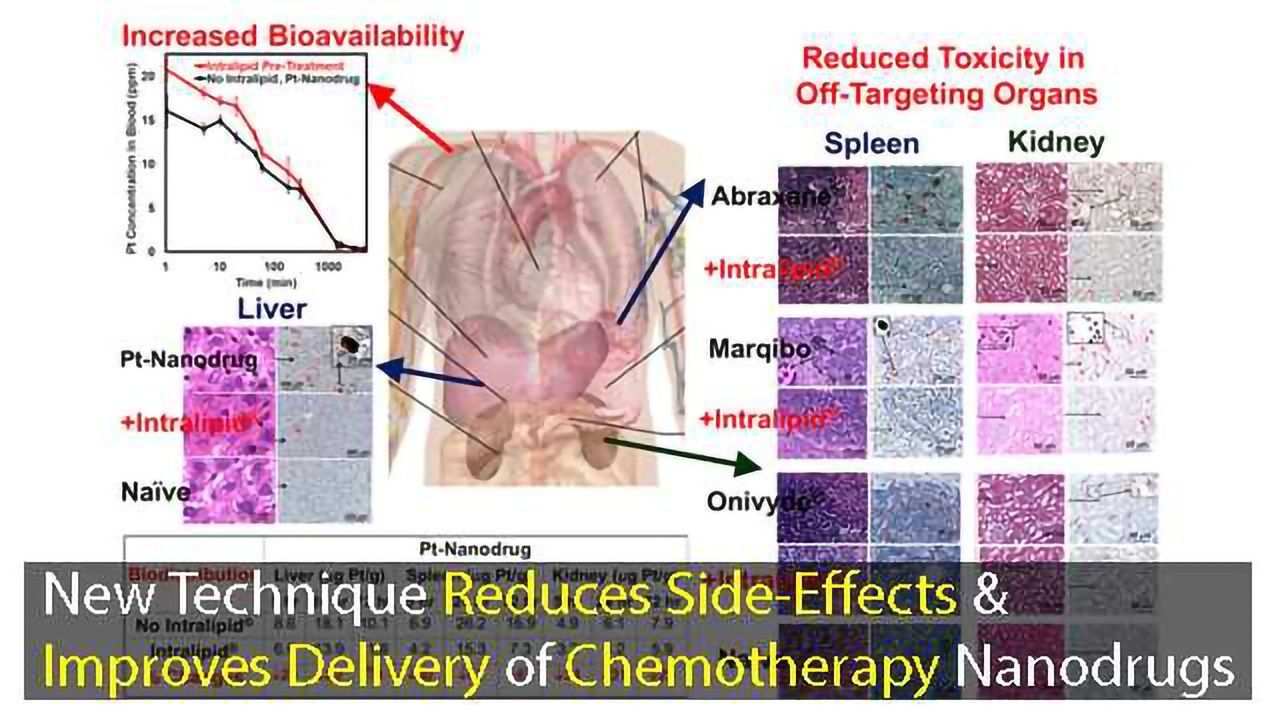 New Chemotherapy Nanodrug Delivery Technique Reduces Side Effects and Improves Bioavailability
