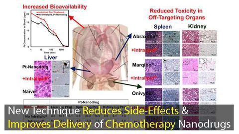 New Chemotherapy Nanodrug Delivery Technique Reduces Side Effects and Improves Bioavailability