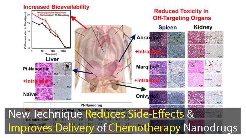 New Chemotherapy Nanodrug Delivery Technique Reduces Side Effects And