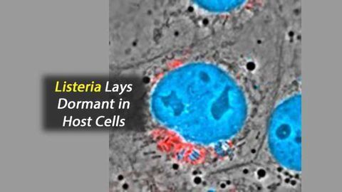 Listeria Shown to Hide in Host Cells