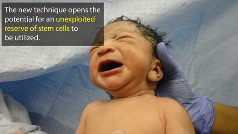 Mesenchymal Stem Cells can be Harvested from Amniotic Fluid During Caesareans
