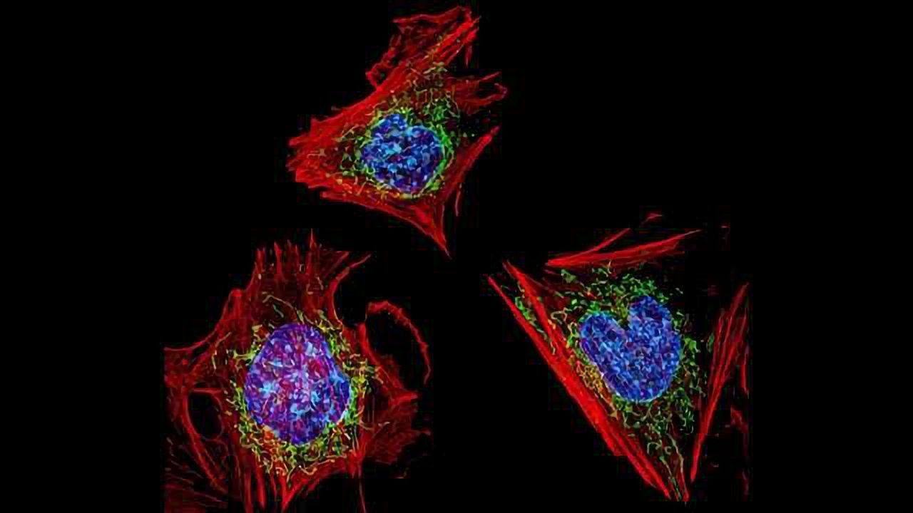 GE Launches DeltaVision™ Ultra Microscopy System for Imaging and Analysis of Cell Biology in One Integrated Platform