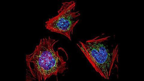 GE Launches DeltaVision™ Ultra Microscopy System for Imaging and Analysis of Cell Biology in One Integrated Platform