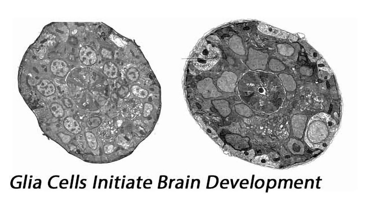 Glia Initiate Brain Assembly Through Axon Guidance