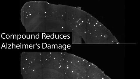 Targeted Antisense Treatment of APOE4 Reduces Alzheimer's Damage