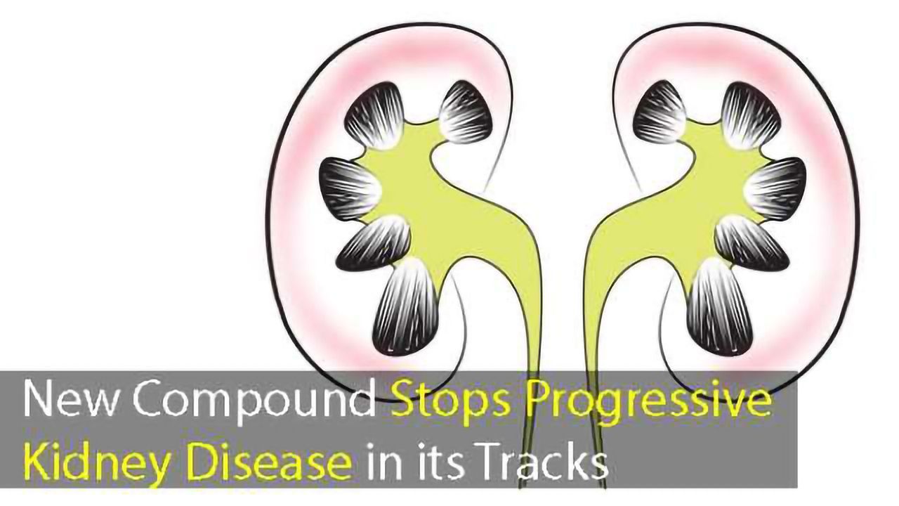 Progressive Kidney Disease: New Compound Restores Kidney Function